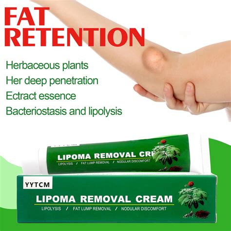 Lipoma Removal Cream Treat Skin Swelling Tumor Removes Subcutaneous Lipoma Lumps Tubercle Care ...