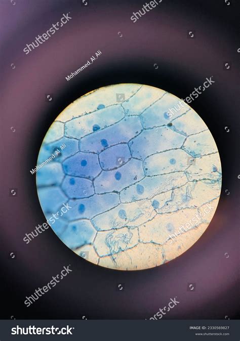Plant Cell Vacuole Microscope