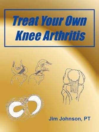 Amazon.in: Buy Treat Your Own Knee Arthritis Book Online at Low Prices ...