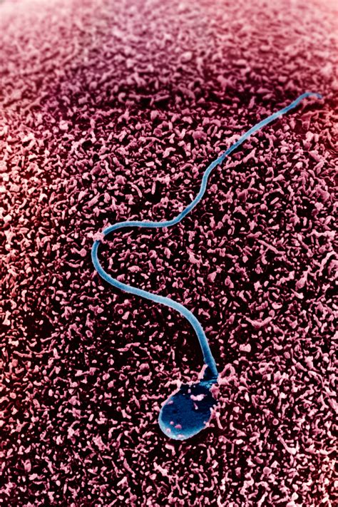 Sperm Cell Under Microscope