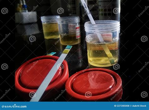 Urine Sample Along with a Dipstick Uristix To Test Urine Glucose and ...