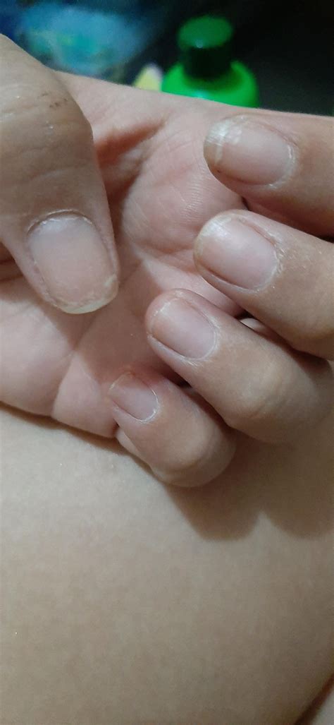 How do I improve my nails' health? : r/Nails