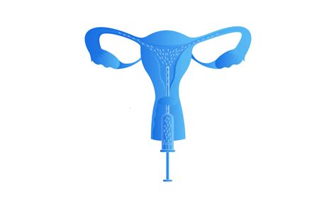 Human Artificial Insemination