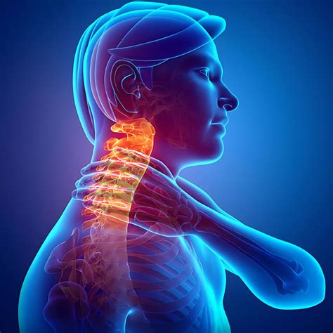 Neck Pain and Stiffness | Root Causes and Relief Exercises