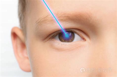 激光和小男孩的眼睛特写。 眼科医生进行视力矫正照片-正版商用图片18aces-摄图新视界