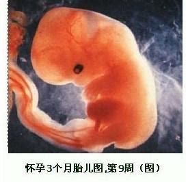 懷孕幾個月胎兒四肢長全？這個階段容易胎停、流產和畸形，別大意 - 每日頭條