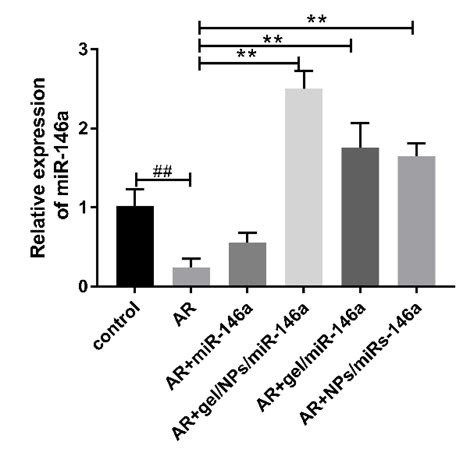 Chitosan Hydrogel Doped with PEG-PLA Nanoparticles for the Local ...
