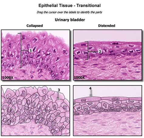 Image result for Transitional Epithelial Cells
