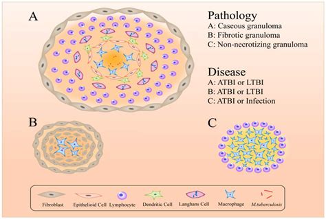 The Immune Escape Mechanisms of Mycobacterium Tuberculosis