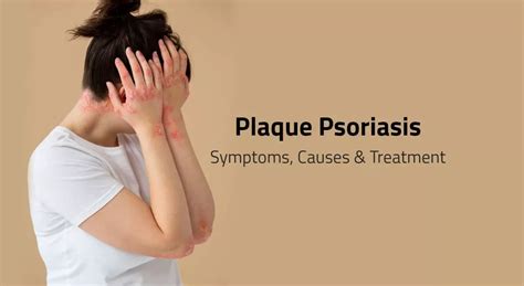 Understanding Psoriasis: Chronic Skin Condition | Aster CMI Hospital ...