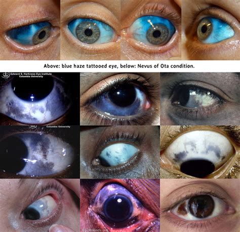 Image result for Iris Recognition Using MATLAB Source Code