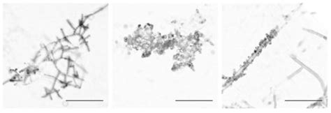 Microorganisms | Special Issue : The Filamentous Fungus Neurospora crassa
