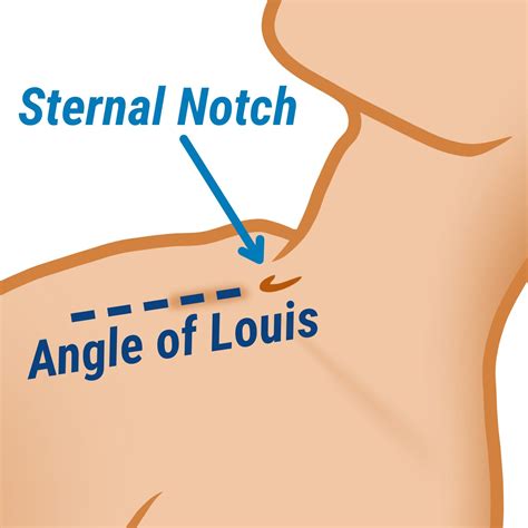 Jugular Vein Pulsation - Delaware Vein Center