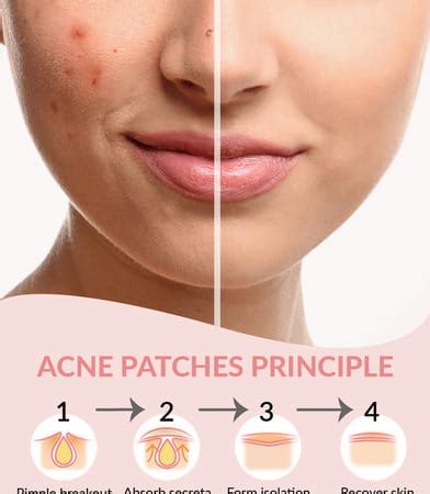 Buy PRIVEDA ULTRATHIN INVISIBLE ACNE PIMPLE PATCH 57 UNITS HYDROCOLLOID ...