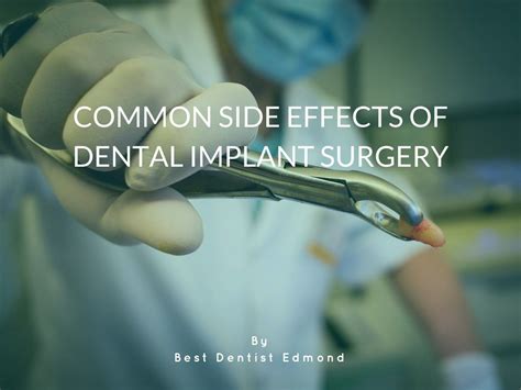 PPT - Common Side Effects of Dental Implant Surgery PowerPoint ...