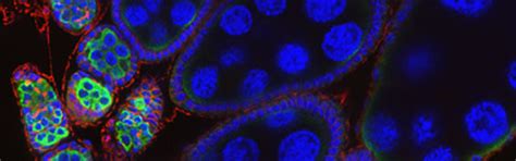 in vivo fly RNAi (TRiP) | DRSC/TRiP Functional Genomics Resources ...