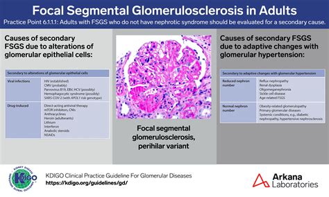 Focal Segmental Glomerulosclerosis