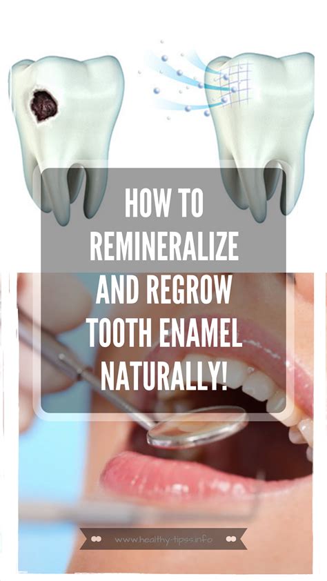How To Make Teeth Enamel Stronger at Ina Pfarr blog