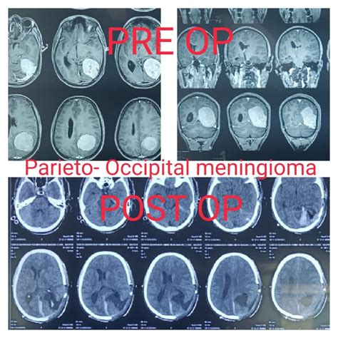 Photo Gallery - Dr Vivek Agrawal