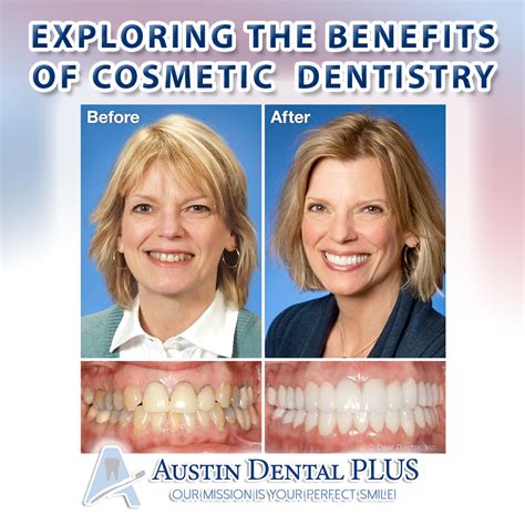 Transform Your Smile with Cosmetic Dentistry - Austin Dental Plus