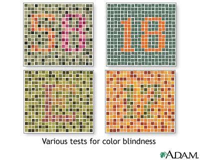 Image result for Super Color Vision Test
