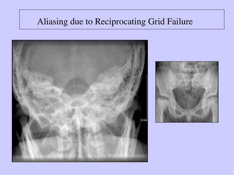 Image result for Aliasing Example