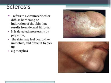 Morphology of skin lesions tim | PDF