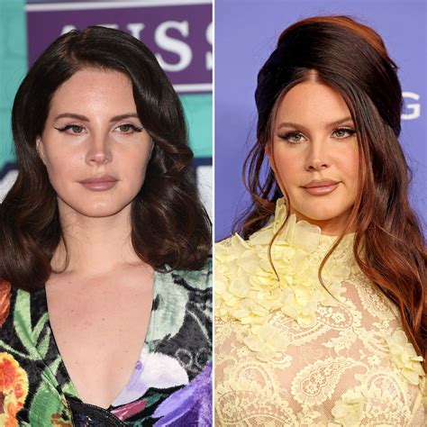 Lana Del Rey Face Surgery