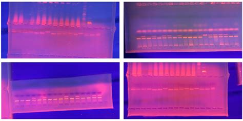 IL-10 A-Allele as a Biomarker for Periodontitis Severity in Bulgarian ...