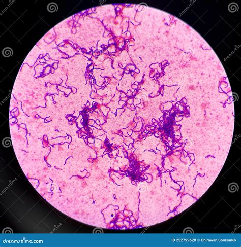 Gram Positive Cocci in Chain Stock Photo - Image of medical ...