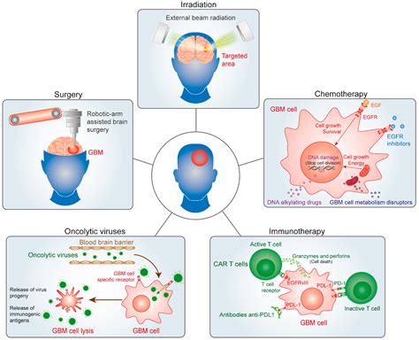 Brain Tumor Surgery Types And Treatments Healthcare In Glioblastoma