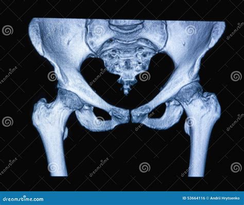 MRI scan of the hip joint stock photo. Image of healthy - 53664116