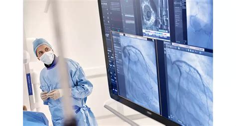 Interventional Cardiology Workspace (Xper IM) | Philips Healthcare