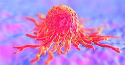 Image result for Cancer Detection Using Graph CNN