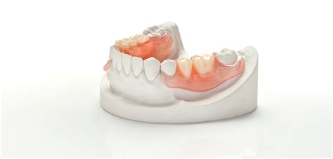 Image result for Partial Denture Procedure