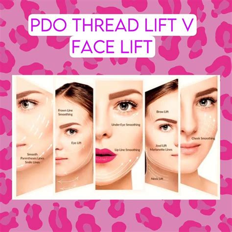 PDO Thread Lift – Non-Surgical Face Lift - Beauty by Laura Jayne