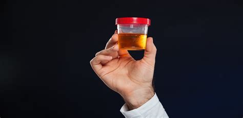 Top 5 Diseases That Can be Detected with a Simple Urine Test | Max Lab