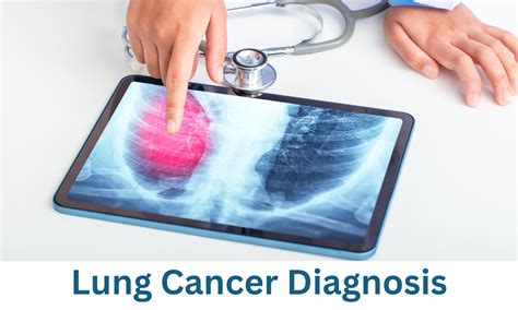 Lung Cancer Diagnosis - Proton Therapy