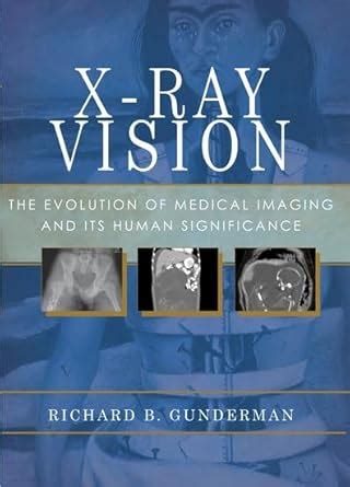 Buy X-Ray Vision: The Evolution of Medical Imaging and Its Human ...