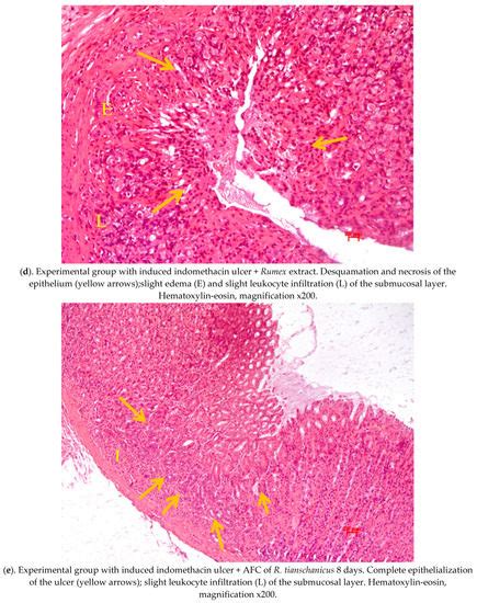 Antiulcer Activity of Anthraquinone–Flavonoid Complex of Rumex ...