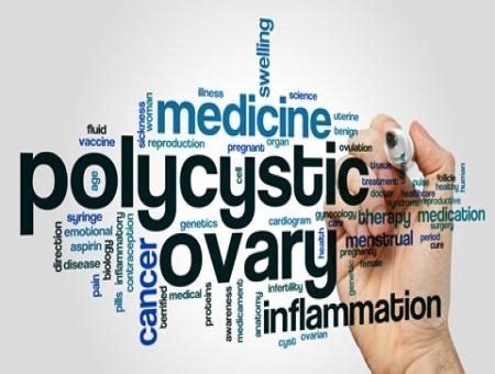 Know More About the Commonest Hormonal Disorder-Poly cystic Ovarian ...