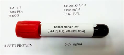 Afp Tumor Marker Accuracy at April Hyde blog