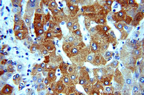MPV17 antibody (10310-1-AP) | Proteintech