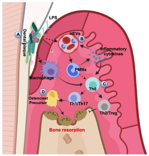 Impact of Oral Microbiome in Periodontal Health and Periodontitis: A ...