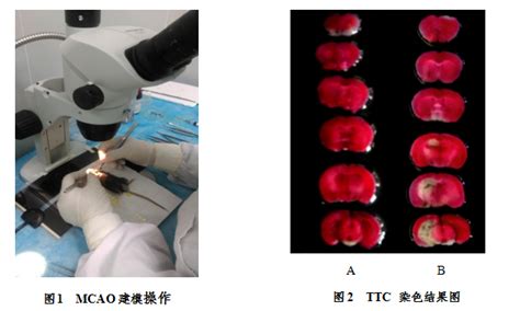 山东省药学科学院 | 新药药理研究中心采用改良MCAO模型进行大鼠脑缺血—再灌研究