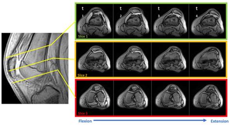 Diagnostics | Special Issue : Advanced MRI in Clinical Diagnosis