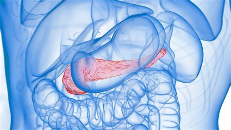 Two Approaches for Infected Necrotizing Pancreatitis Go Head-to-Head ...