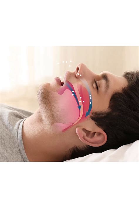 Rahat Uyku İçin Anti Snore Sleep Horlama Engelleyici Aparat Uyku ...