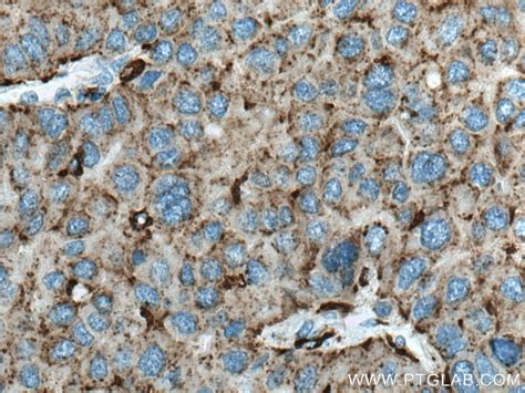 Cathepsin D antibody (66534-1-Ig) | Proteintech
