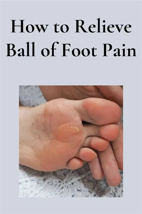 Ball of Foot Pain Running 的图像结果